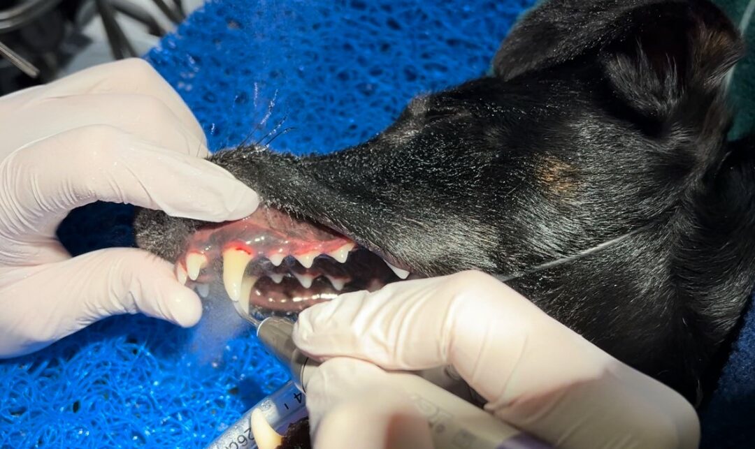 A Dental in two stages